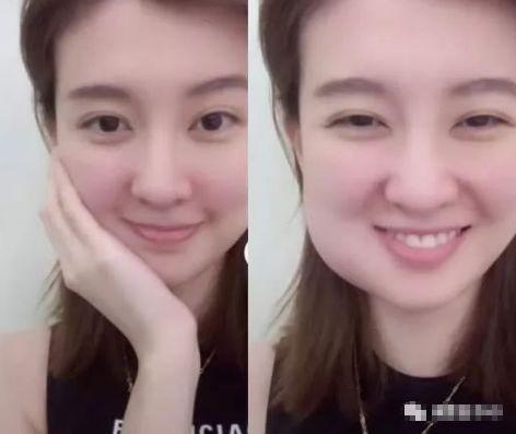 明星网红拔智齿视频大全,网红明星拔智齿全过程大揭秘！