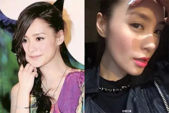 明星网红拔智齿视频大全,网红明星拔智齿全过程大揭秘！
