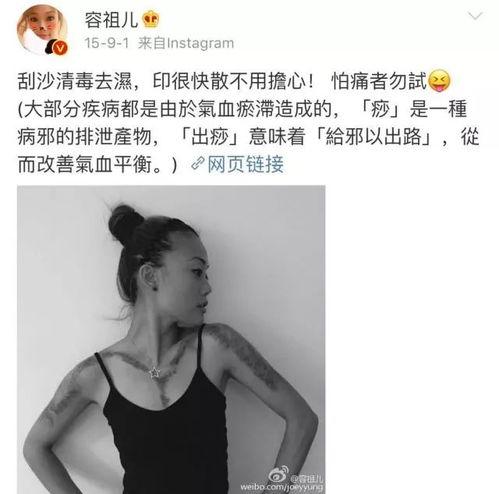 扎针的明星网红有哪些,揭秘扎针网红的神秘世界