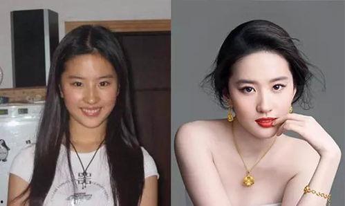 明星网红整容吸脂视频